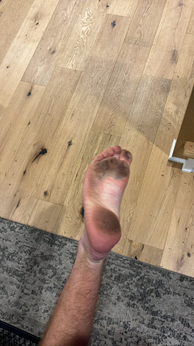 If your feet don’t look like this after a long day of vegetation, what are you doing?