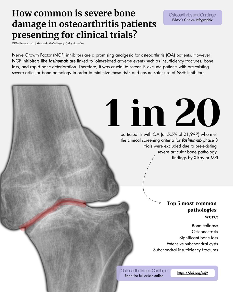 This month's Editor's Choice is out!

How common is severe bone damage in #osteoarthritis patient presenting to a phase-3 Nerve Growth Factor #NGF inhibitor (fasinumab) clinical trial?🧪

Read for free from DiMartino et al. <a href="/Tuhina_Neogi/">Tuhina Neogi, MD, PhD</a> at oarsijournal.com/article/S1063-…