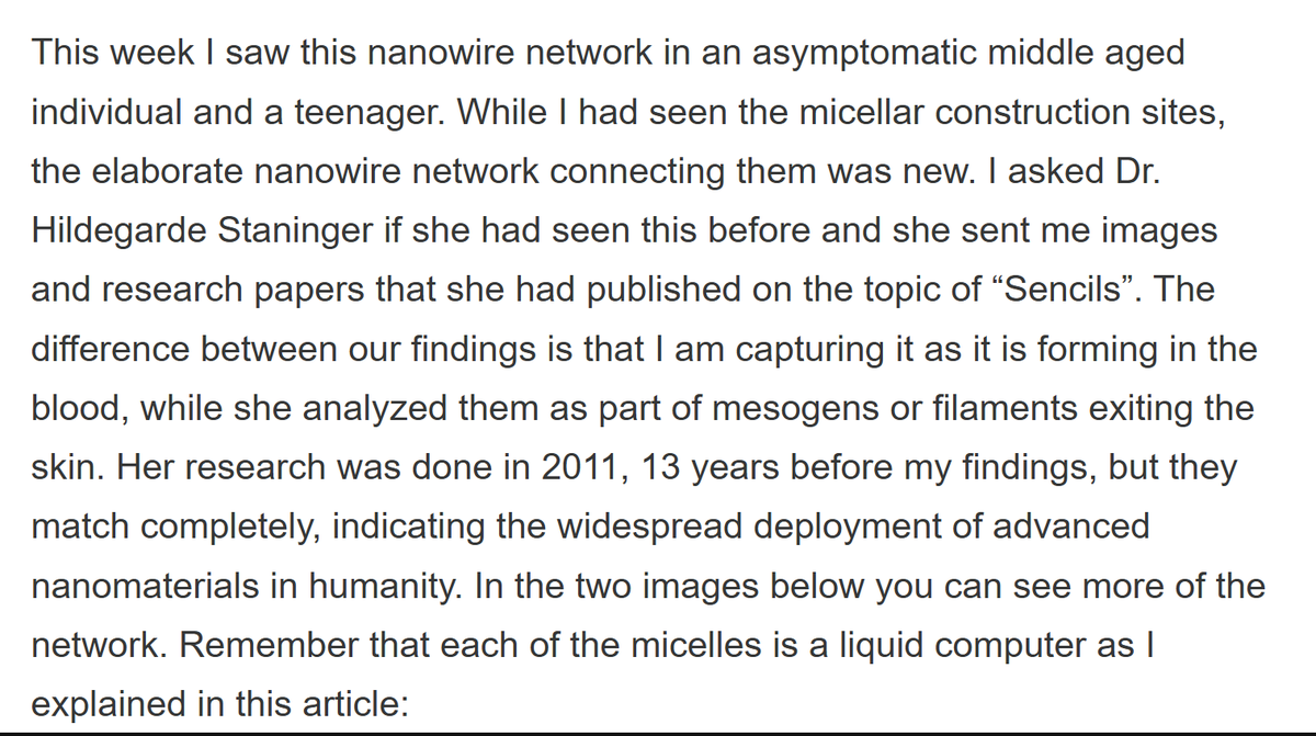 BrianGPowell's tweet image. #NanoTech in #UnVaccinated blood samples too