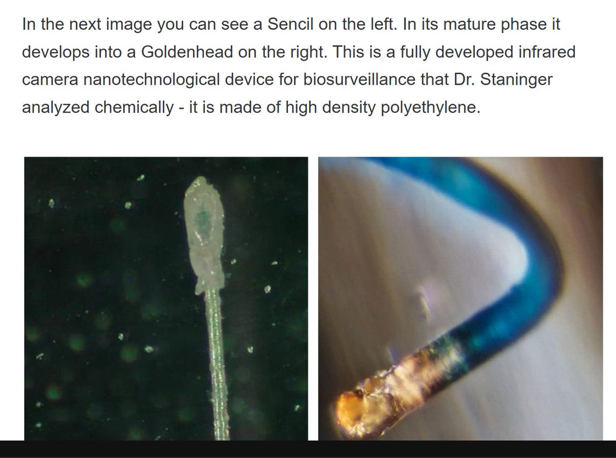 BrianGPowell's tweet image. #NanoTech in #UnVaccinated blood samples too