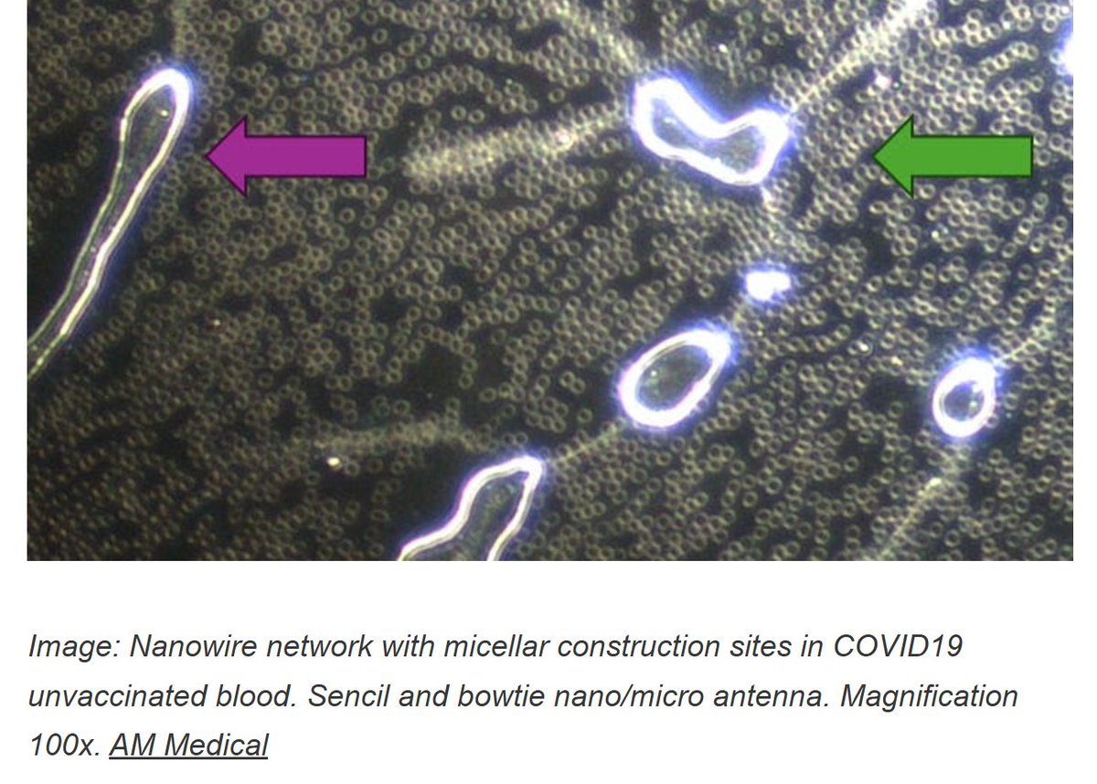 BrianGPowell's tweet image. #NanoTech in #UnVaccinated blood samples too