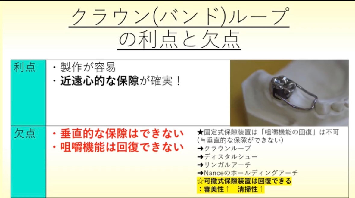 ❏小児歯科、必修対策 『保隙装置』としてよく問われるのは『クラウン
