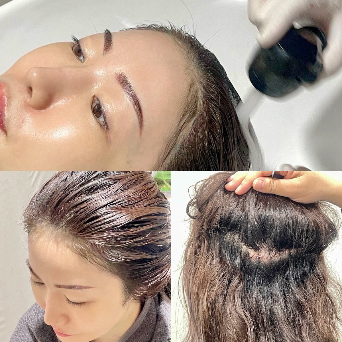 あちゃ(整形垢) (@MNcK4pjVAP7862) / Posts / X