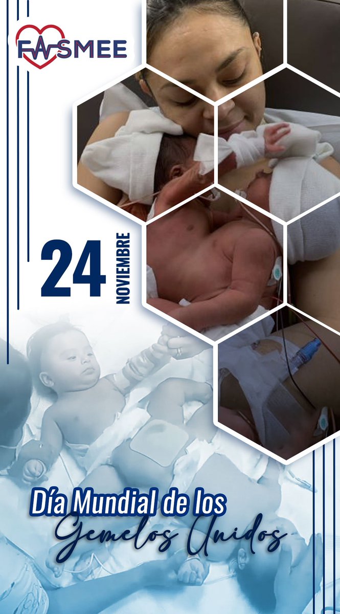 #24Nov
Debido a su singularidad y los retos que implica tanto para los pequeños como para sus familias, las Naciones Unidas proclamaron el 24 de noviembre Día Mundial de los Gemelos Unidos, con miras a crear una mayor conciencia pública sobre la afección de los gemelos unidos.