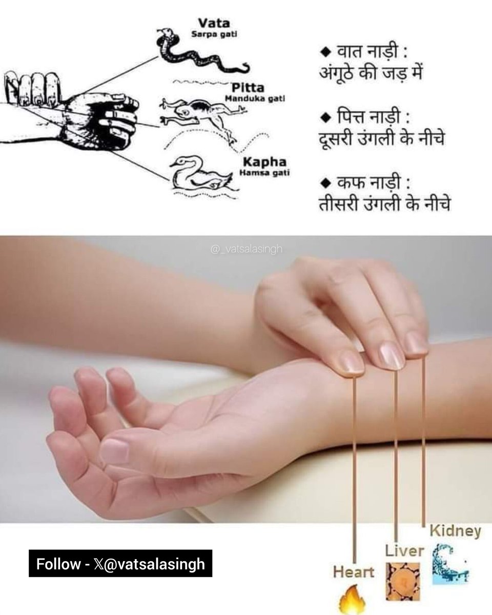 इसे सेव कर सुरक्षित कर लें, ऐसी पोस्ट कम ही आती है..

आयुर्वेद में नाड़ी परीक्षण का विज्ञान...अंत तक जरुर पढ़े🧵