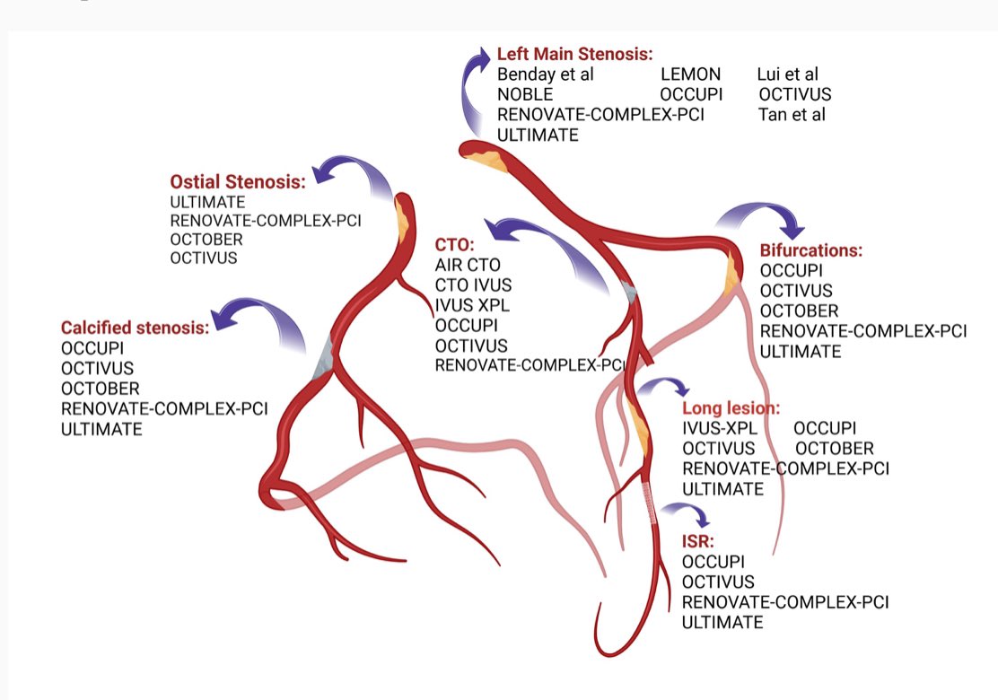 Alex Truesdell (@agtruesdell) on Twitter photo Intra-Coronary Imaging 👁️ for Complex Lesion Subsets (and ideally for all-comers): academic.oup.com/ehjimp/advance…… Intra-Coronary Imaging 👁️ for Complex Lesion Subsets (and ideally for all-comers): academic.oup.com/ehjimp/advance……