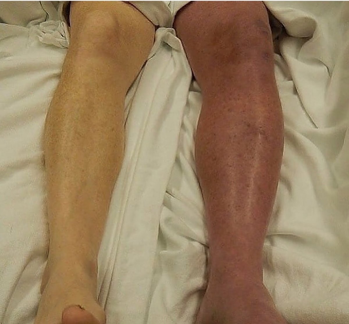 Oren Gottfried, MD tweet media