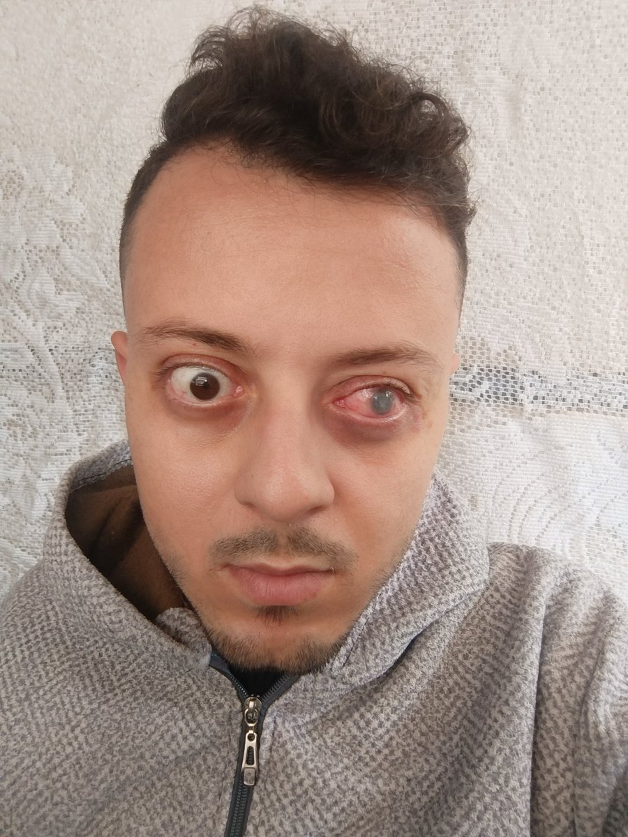 Ahmed Shameya tweet media