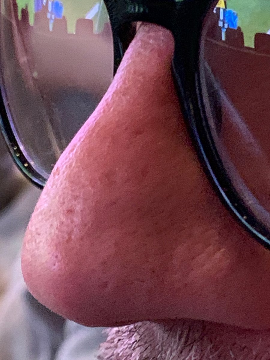 MarkMaddenX's tweet photo. Close up of Mr Friday Afternoon’s nose. #BugleBeak https://t.co/QpUO92iZxb