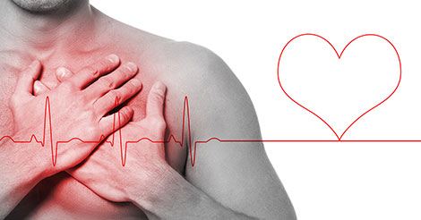 ehsanarj1's tweet image. قلب ما، مهمترین و حیاتی‌ترین عضله ماست که باید مانند سایر عضلات تقویت شود. یک پیاده‌روی ده دقیقه‌ای سریع که ضربان #قلب را به حدود ۱۲۰ تپش در دقیقه افزایش دهد، قلب را تقویت می‌کند. هنگامی که پای مرگ و زندگی در میان است، ده دقیقه وقت گذاشتن کار سختی نخواهد بود.
از #درد بدور باشید!