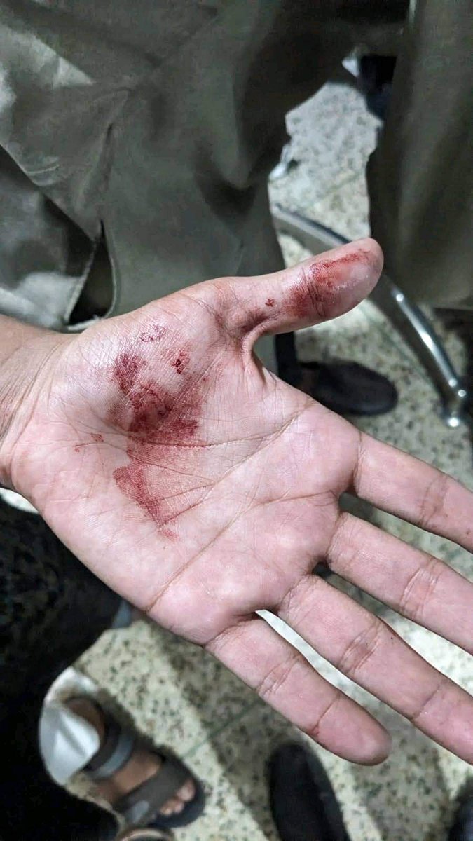 talibulilmr's tweet photo. BREAKING NEWS: 🇧🇩 

Today in Bangladesh common people protested against Prothom Alo and Daily Star media. the police force attacked the protesters and left them bloody. There are allegations with clear evidence against Prothom Alo and Daily Star who were conducting terrorist activities with India against Bangladeshi Muslims.

They used to fabricate false stories of militancy against Muslims and keep them captive. There are also accusations of stance against Muslim culture and Islam of Bangladesh and against the country's sovereignty

#Bangladesh #boycottProthomAlo