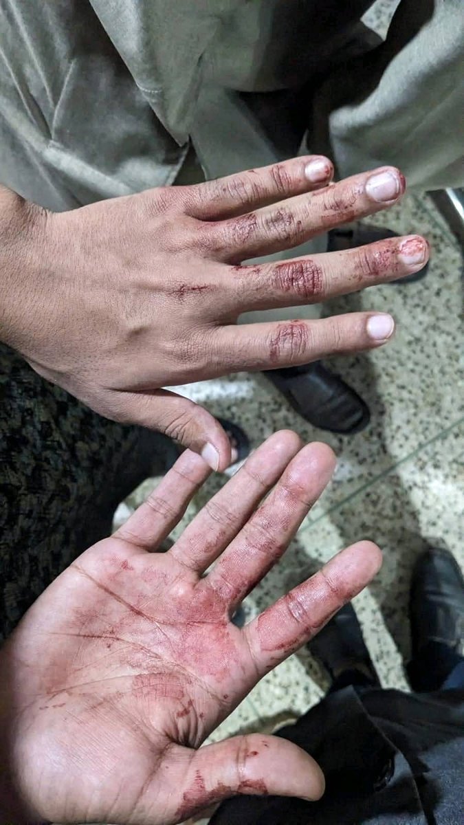 talibulilmr's tweet photo. BREAKING NEWS: 🇧🇩 

Today in Bangladesh common people protested against Prothom Alo and Daily Star media. the police force attacked the protesters and left them bloody. There are allegations with clear evidence against Prothom Alo and Daily Star who were conducting terrorist activities with India against Bangladeshi Muslims.

They used to fabricate false stories of militancy against Muslims and keep them captive. There are also accusations of stance against Muslim culture and Islam of Bangladesh and against the country's sovereignty

#Bangladesh #boycottProthomAlo