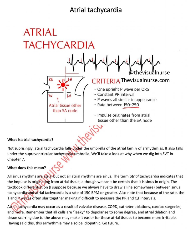 ZHeart11768530's tweet photo. 🔴Atrial Tachycardia 🫀
#ecg #ekg #cardiology #ecginterpretation #electrocardiograma #electrocardiogram #nursing #cardiologista #healthy #interpretation #heart #nurse #hearts #heartbeat #ccu #cardio #cardiovascular #quiz #cardiologia #physicianassistant #medical #treatment https://t.co/jgQmM6BJHH