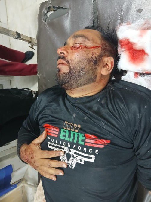 Atifrauf79's tweet photo. مظاہرین کے پتھراؤ سے پولیس اہلکار زخمی ہو گئے تشویشناک حالت میں ہسپتال منتقل
یہ ہے پر امن احتجاج۔ 🥲 https://t.co/nAhjyrBRnG
