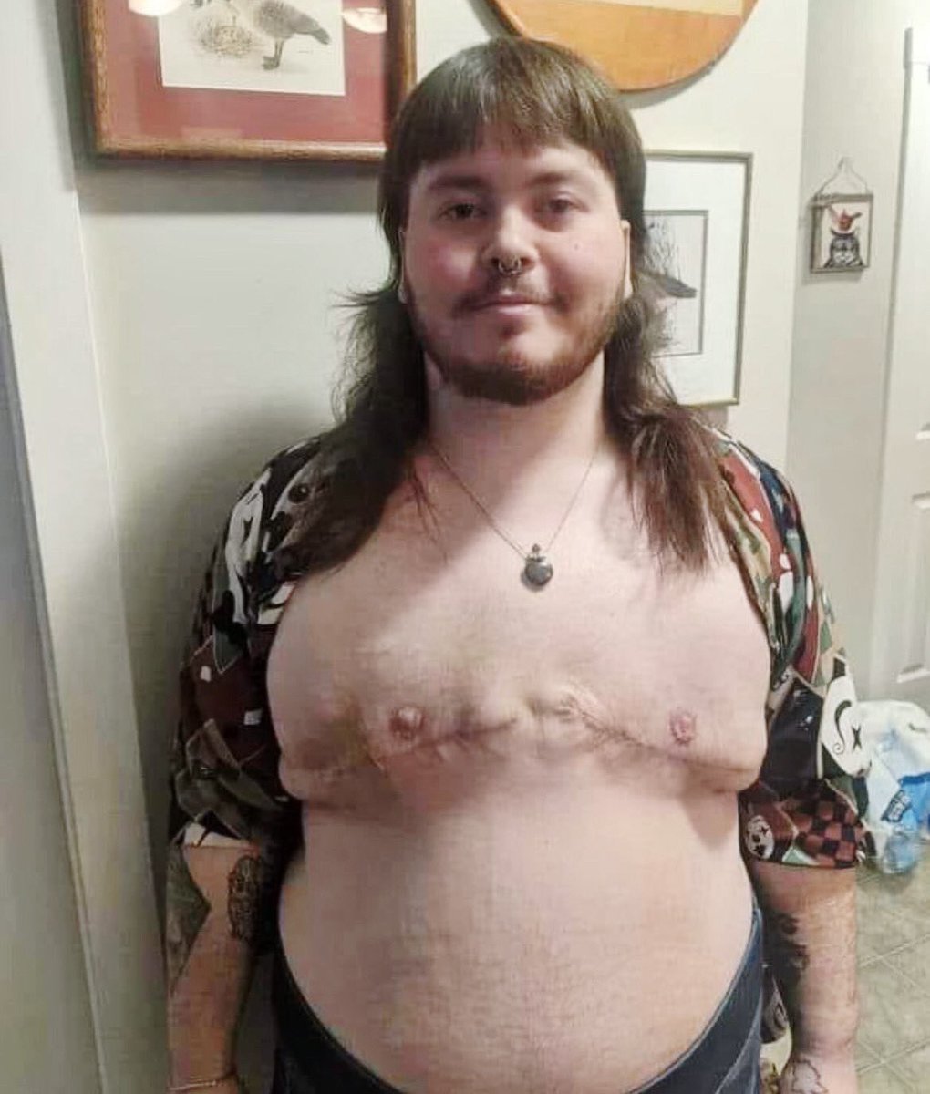 A reminder: “Transphobia” is against this happening to girls ⬇️