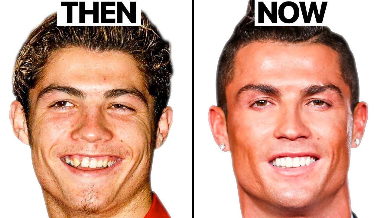 cac-bac-si-tham-my-tin-rang-ronaldo-co-can-thiep-phau-thuat-de-co-dien-mao-nhu-hien-nay