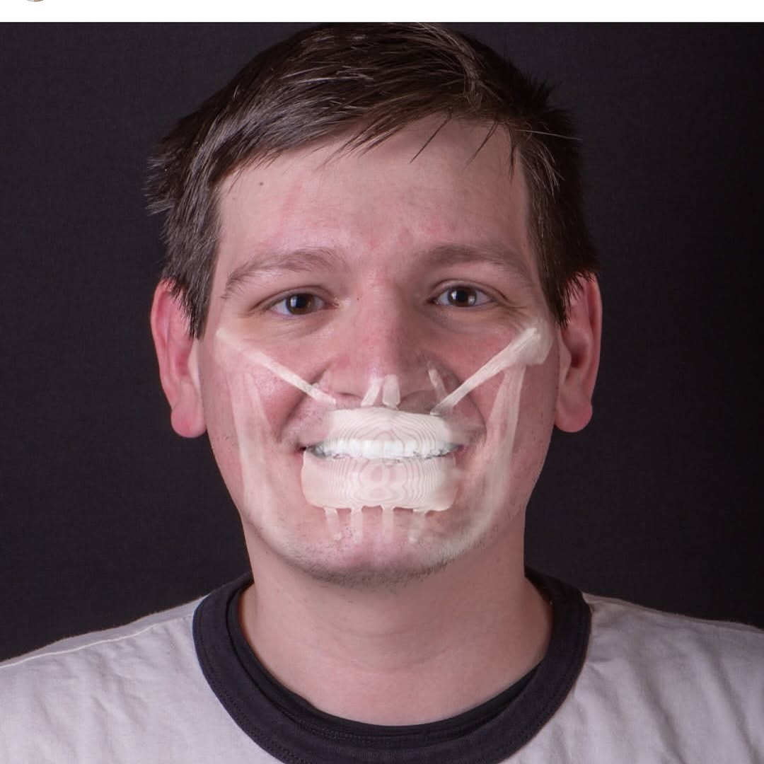 asnan_tbyb's tweet photo. Do you know power of dentistry?

Did you see it ? https://t.co/N3JXbpGJYt