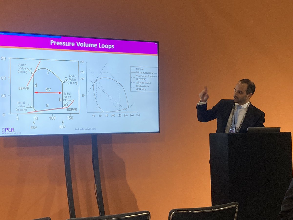 Harriet Hurrell (@dr_harriet) on Twitter photo 🫀 Excellent insights into current research in the field of Mitral valve disease
#PCRLV <a href="/PCRonline/">PCRonline 🫀</a> - Room4
🌟Tend-ring registry data
🌟PVL loops in chronic and acute MR
🌟Epygon TMVI
<a href="/TagliariPaula/">Ana Paula Tagliari</a> <a href="/EZancanaroMD/">Edoardo Zancanaro MD</a> <a href="/ABeneduceMD/">Alessandro Beneduce</a> <a href="/cvnurselin/">Lynne Hinterbuchner</a> <a href="/CurioJonathan/">Jonathan Curio</a> <a href="/guilbon/">Guillaume Bonnet</a> <a href="/PamelaGatto/">Pamela Gatto</a> 🫀 Excellent insights into current research in the field of Mitral valve disease
#PCRLV <a href="/PCRonline/">PCRonline 🫀</a> - Room4
🌟Tend-ring registry data
🌟PVL loops in chronic and acute MR
🌟Epygon TMVI
<a href="/TagliariPaula/">Ana Paula Tagliari</a> <a href="/EZancanaroMD/">Edoardo Zancanaro MD</a> <a href="/ABeneduceMD/">Alessandro Beneduce</a> <a href="/cvnurselin/">Lynne Hinterbuchner</a> <a href="/CurioJonathan/">Jonathan Curio</a> <a href="/guilbon/">Guillaume Bonnet</a> <a href="/PamelaGatto/">Pamela Gatto</a>