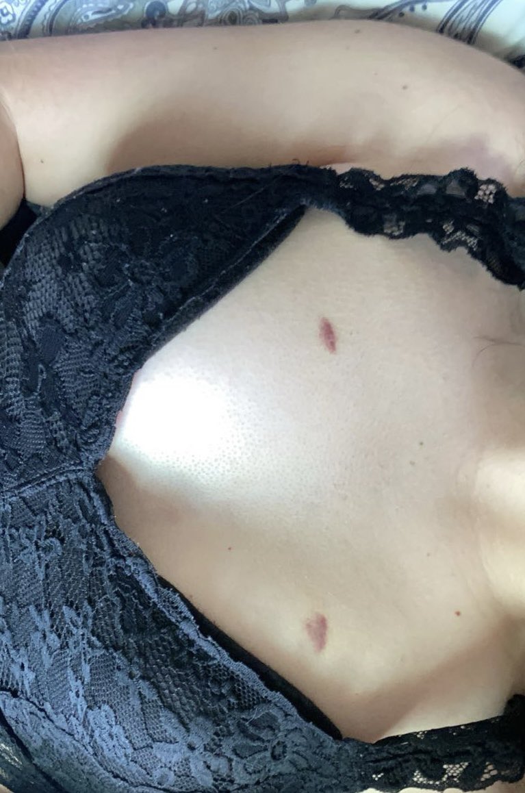sage_watersx's tweet photo. Hickeys as gifts (though I prefer big ones)🥵

#nsfw #nsfwtwt #horny #dm #dmme https://t.co/SeODWw4s4O