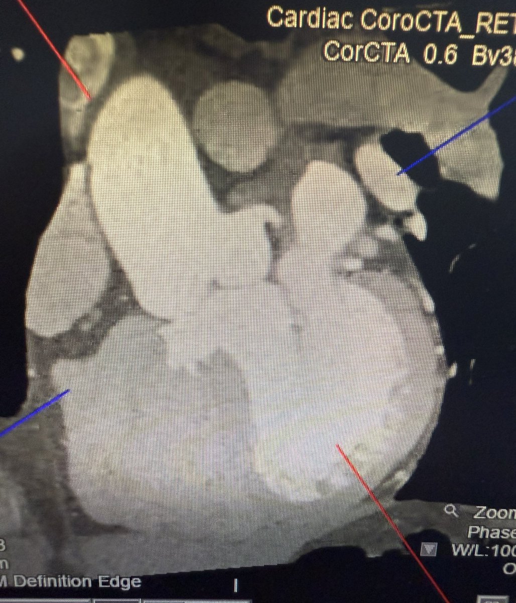 nadeemnimri's tweet photo. What’s going on here? #yescct #echofirst https://t.co/mEoQMxeKCQ