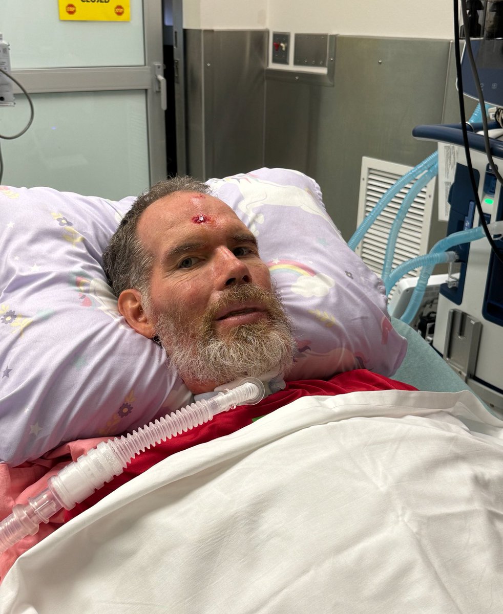 SteveGleason's tweet image. Steve had an accident exiting his van yesterday to speak at the Gleason Life Skills Volleyball Clinic. It was traumatic for him and for all of us who witnessed him mangled on the asphalt. Although he is hurt, it could have been much worse. 

Miraculously, he was spared greater…