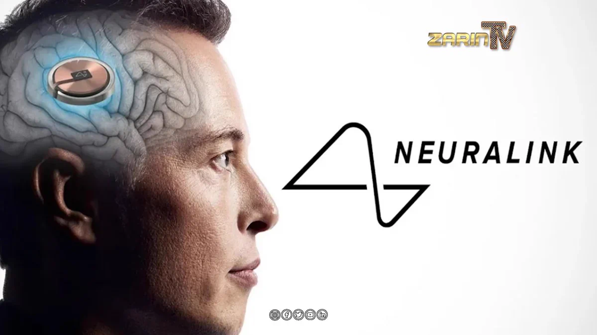 آغاز اولین آزمایش بین‌المللی تراشه مغزی توسط نورالینک