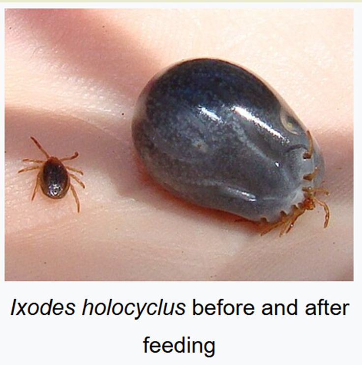 Tick Paralysis
•Progressive ascending paralysis, confused with GBS.
•DTRs absent
•Goes to cranial nerves
• No autonomic dysfunction (common in GBS)
• GBS no pupil problem. Tick hits pupils
Normal CSF protein(high GBS)
EMG unremarkable
Tick paralysis resolves withtick removal