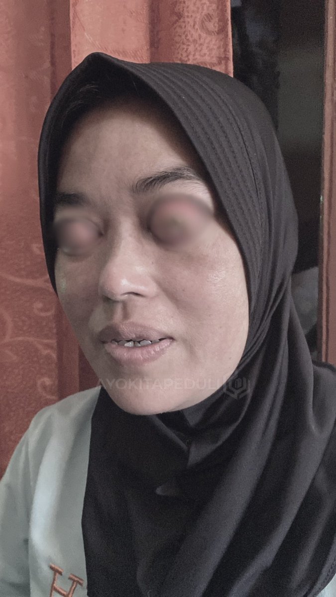 ayokitapeduli_'s tweet photo. Sumpah nggak tega banget liat beliau 😭 Kedua bola matanya hampir keluar, setiap hari juga air mata keluar terus-menerus dan gak bisa tidur karena kesakitan

Bu Ade menderita kanker mata sejak 2 tahun lalu dan pengobatannya kehalang biaya karena penghasilan suaminya minim. https://t.co/kJZprzcr1m