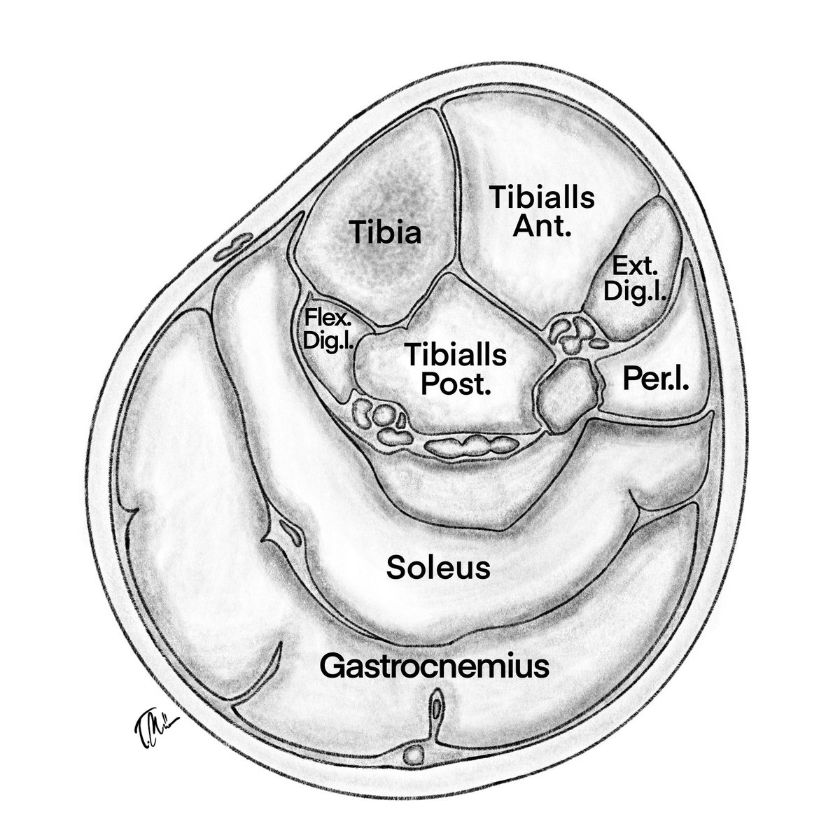 Graphics_Unset's tweet photo. Top down view of the muscle groups and bones found with in the leg. 🦵 #medicalillustrations https://t.co/GF6UOEWRdb