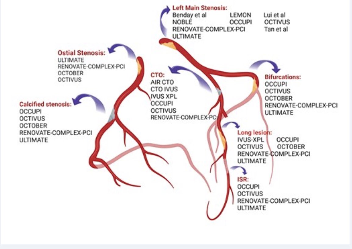 EHJIMPEiC's tweet image. 🔥🔥 Hot off the press 🔥🔥
Image guided percutaneous #revascularization of the coronary arteries by @mirvatalasnag and colleagues ➡️ academic.oup.com/ehjimp/advance… @ESC_Journals @alessia_gimelli @EACVIPresident @VDelgadoGarcia