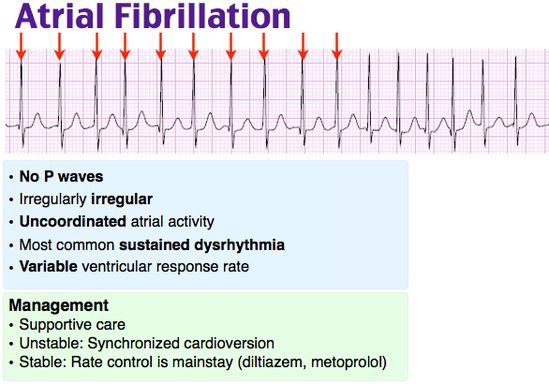 QAlmulihi's tweet image. Management of Atrial Fibrillation in the ED

1️⃣Rhythm Control
•Synchronized Cardioversion:
•🚨 Unstable patients or  &amp;lt;65 years with new/paroxysmal AF (&amp;lt;48 hours).
•&amp;lt;48 hours: Cardioversion without anticoagulation.
•&amp;gt; 48 hours: Anticoagulate, then outpatient referral for…