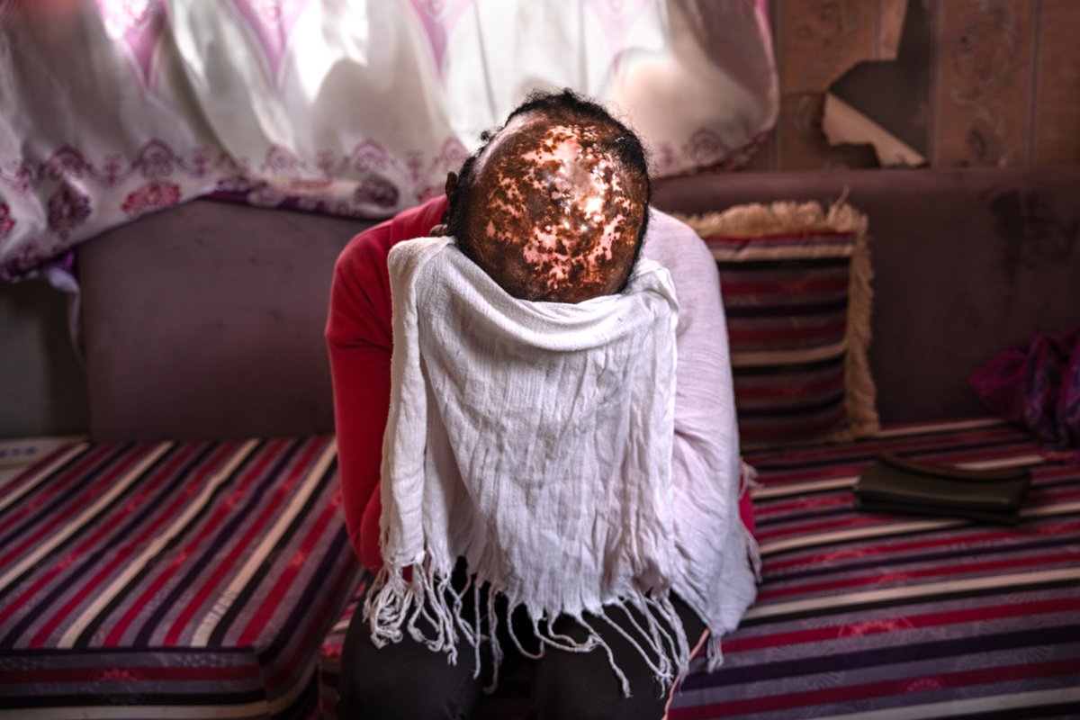 XimenaBorrazas's tweet photo. International Day for the Elimination of Violence against Women, a day to remember how much remains to be done.

Violence against women is used in a thousand ways and in a thousand circumstances. Armed conflicts are no exception, where women's bodies become battlefields. https://t.co/nkKPwO72tW