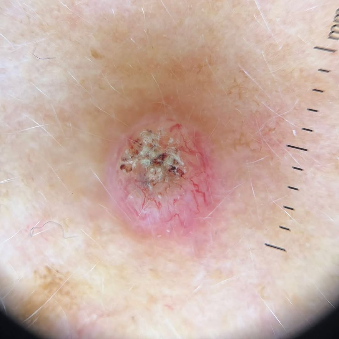 schowardjd's tweet photo. What's the diagnosis❔ https://t.co/CWHeJqfB7U