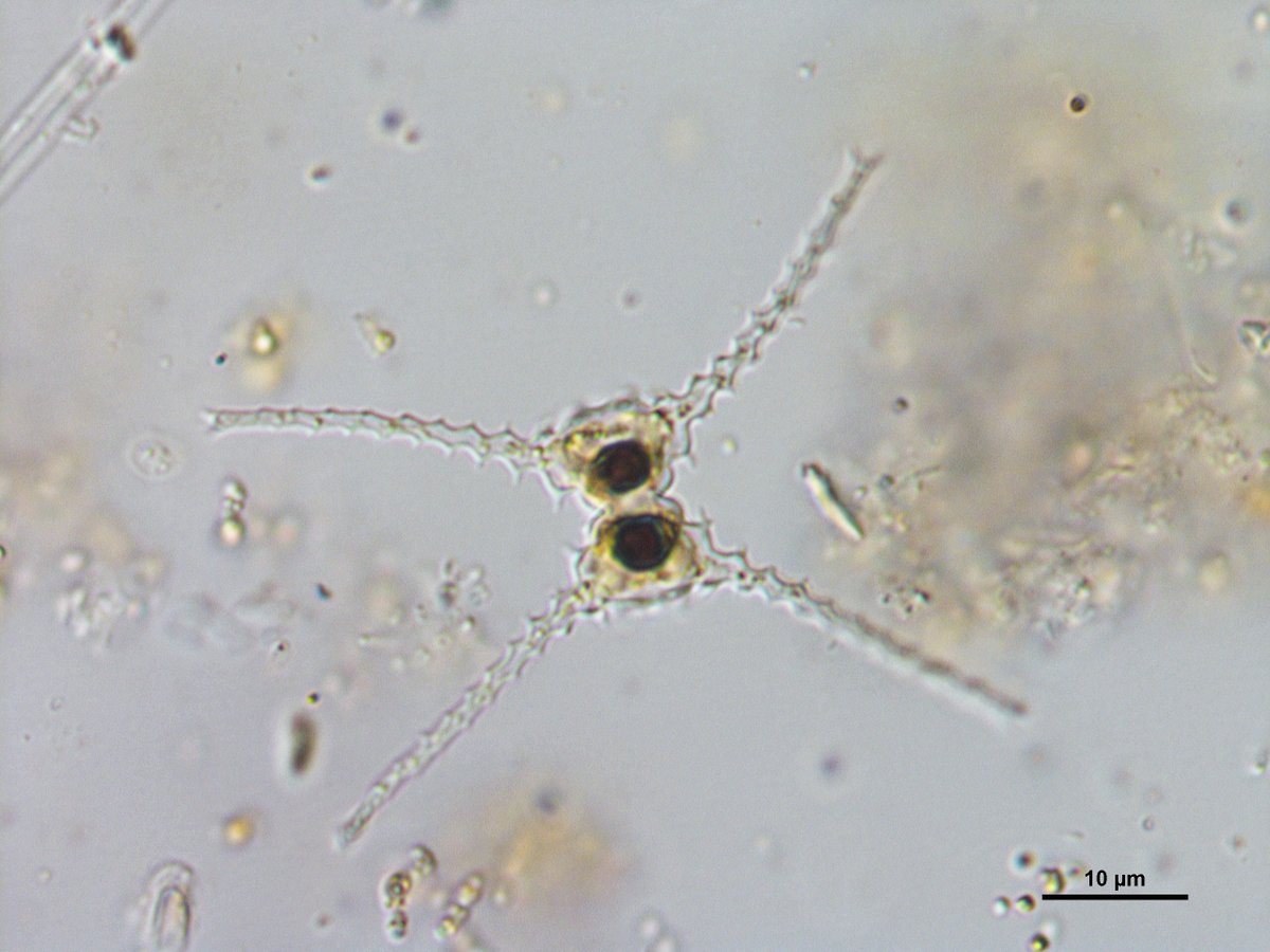 misteralgae's tweet photo. Staurastrum chaetoceras, Étang Blanc, September 2012, France #Desmids #Staurastrum https://t.co/e1uWYkhFPz