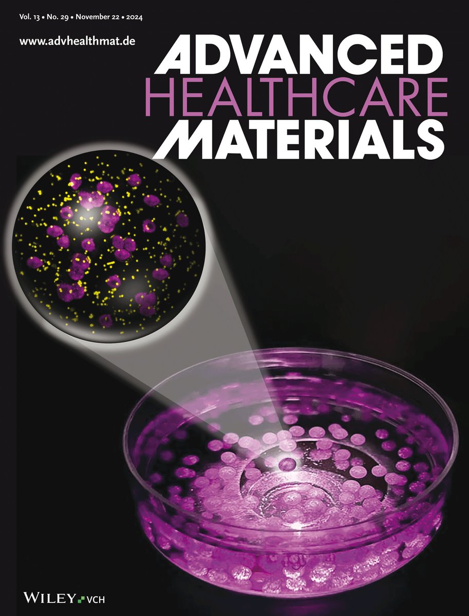 Loretta L. del Mercato (@lorettamercato) on Twitter photo Many thanks to Advanced Healthcare Materials <a href="/WileyVCH/">Wiley-VCH</a> for featuring our study in Issue 29! Special thanks #HelenaIuele for creating the beautiful artwork!
<a href="/CNRsocial_/">CNR Consiglio Nazionale delle Ricerche</a> <a href="/CnrNanotec/">Cnr Nanotec</a> <a href="/CnrIgb/">CNR IGB - Institute of Genetics and Biophysics ABT</a> <a href="/TecnoMed_Puglia/">TecnoMed_Puglia</a> <a href="/unisalento/">UniSalento</a>
<a href="/ERC_Research/">European Research Council (ERC)</a> <a href="/AIRC_it/">Fondazione AIRC per la ricerca sul cancro</a> <a href="/ItalianPCC/">Italian Pancreatic Cancer Community I-PCC</a>
onlinelibrary.wiley.com/doi/10.1002/ad… Many thanks to Advanced Healthcare Materials <a href="/WileyVCH/">Wiley-VCH</a> for featuring our study in Issue 29! Special thanks #HelenaIuele for creating the beautiful artwork!
<a href="/CNRsocial_/">CNR Consiglio Nazionale delle Ricerche</a> <a href="/CnrNanotec/">Cnr Nanotec</a> <a href="/CnrIgb/">CNR IGB - Institute of Genetics and Biophysics ABT</a> <a href="/TecnoMed_Puglia/">TecnoMed_Puglia</a> <a href="/unisalento/">UniSalento</a>
<a href="/ERC_Research/">European Research Council (ERC)</a> <a href="/AIRC_it/">Fondazione AIRC per la ricerca sul cancro</a> <a href="/ItalianPCC/">Italian Pancreatic Cancer Community I-PCC</a>
onlinelibrary.wiley.com/doi/10.1002/ad…