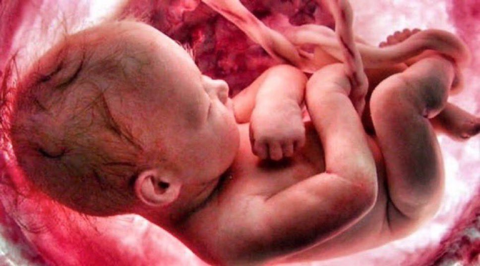 porlavida2014's tweet photo. El #aborto es moralmente un crimen abominable aunque esté protegido por la legislación. Nada puede cambiar el hecho fundamental de que mediante esta práctica se mata a un ser humano.
#SiAlaVida https://t.co/hHhUYX8ynx