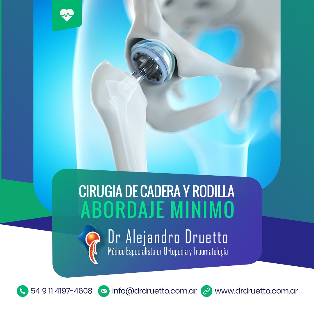 drdruetto's tweet photo. ARTROPLASTIA TOTAL DE CADERA Y RODILLA
Técnica Mini Invasiva.
⁣⁣⁣
⁣⁣Las técnicas Mini Invasivas han mejorado la recuperación en los pacientes. Internación 1 día. Tiempo de quirófano menor, menos riesgos, incisiones más pequeñas y movilidad en horas.⁣⁣⁣⁣⁣ https://t.co/H4rGhGZ9Oz