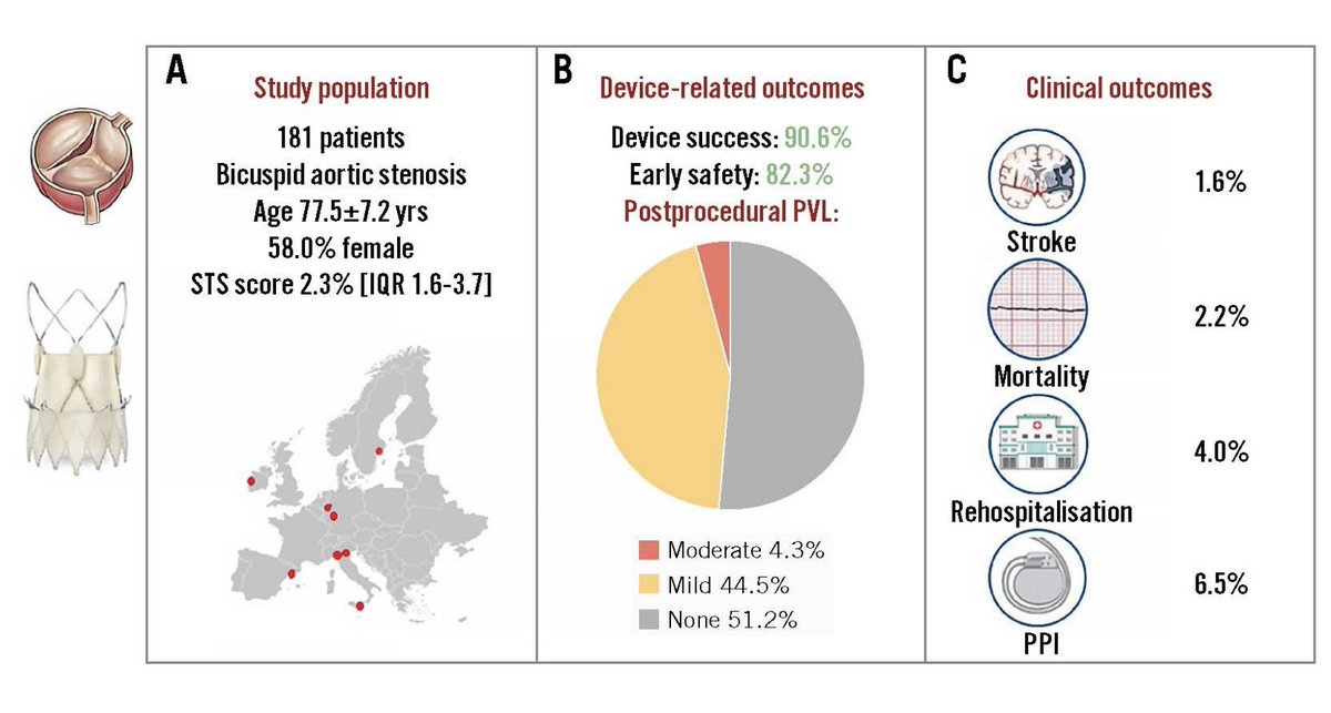 Andreas Rück (@andreasrck2) on Twitter photo 181 bicuspid #TAVR with Acurate neo2: only 4% moderate PVL, mean gradient 6 mmHg, new pacemaker 6%. Read the paper at <a href="/EuroInterventio/">EuroIntervention</a>. <a href="/dmylotte/">Darren Mylotte</a> <a href="/MSettergren/">Magnus settergren</a> 181 bicuspid #TAVR with Acurate neo2: only 4% moderate PVL, mean gradient 6 mmHg, new pacemaker 6%. Read the paper at <a href="/EuroInterventio/">EuroIntervention</a>. <a href="/dmylotte/">Darren Mylotte</a> <a href="/MSettergren/">Magnus settergren</a>