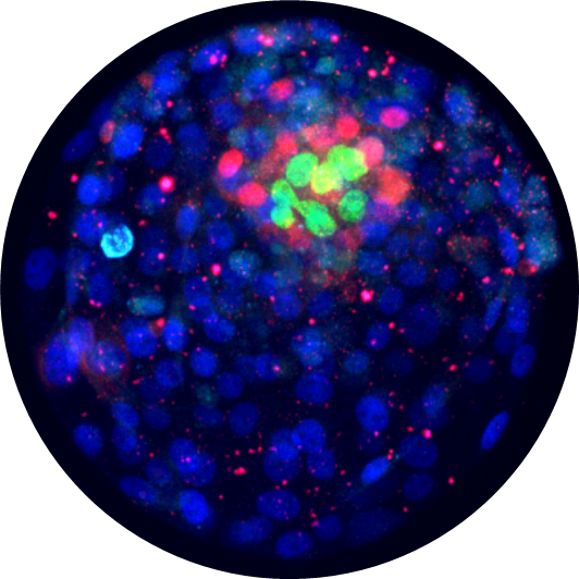 Stanley E. Strawbridge (@stanstrawbridge) on Twitter photo 🚨A PhD project to develop an in vitro human implantation platform is available with an interdisciplinary supervisory team of <a href="/emmafromthelab/">Dr. Emma Lucas</a>, <a href="/IvanaBarbaric3/">Ivana Barbaric</a>, <a href="/3dBiomat/">Claeyssens group</a>, and myself.
#embryo #endometrium #biomaterials #blastoids #endometrialAssembloids
tinyurl.com/ycykmwv4 🚨A PhD project to develop an in vitro human implantation platform is available with an interdisciplinary supervisory team of <a href="/emmafromthelab/">Dr. Emma Lucas</a>, <a href="/IvanaBarbaric3/">Ivana Barbaric</a>, <a href="/3dBiomat/">Claeyssens group</a>, and myself.
#embryo #endometrium #biomaterials #blastoids #endometrialAssembloids
tinyurl.com/ycykmwv4