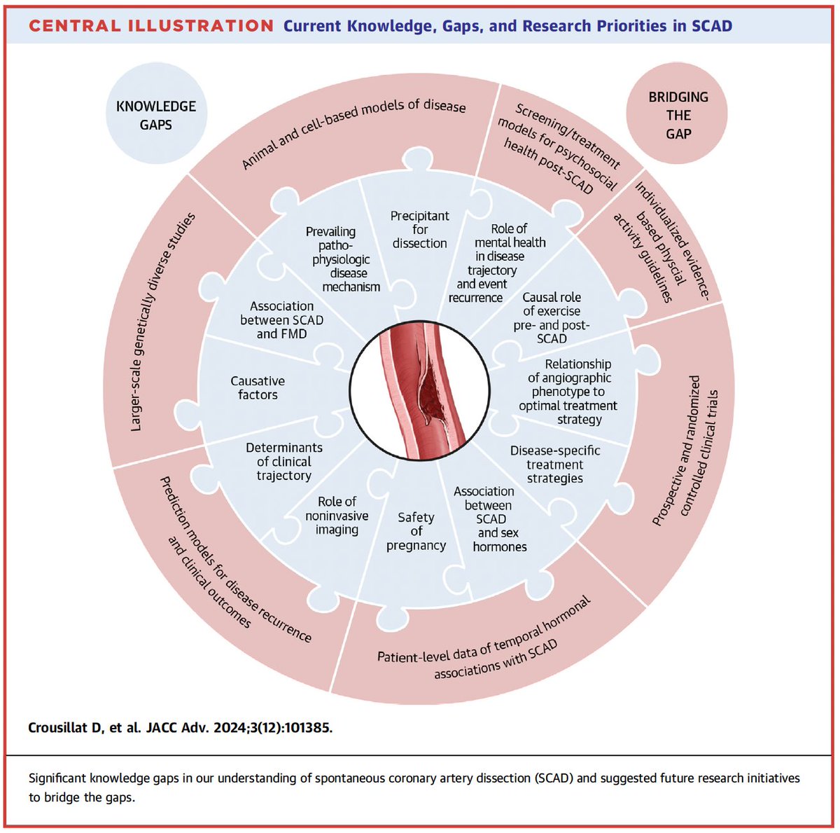 Gonzalo Perez (@gonzaeperez) on Twitter photo DISECCIÓN CORONARIA ESPONTÁNEA
#SCAD
Revisión <a href="/JACCJournals/">JACC Journals</a> 🆓
🔴Entidad con muchos "gaps" en el conocimiento 🤔
🔴Fisiopatología: hematoma intramural, flap, hormonas femeninas, genética, etc 🤯
🔴Dx: CCG o tomografía
🔴Tratamiento: 💊SAPT y betabloqueantes?
PCI o CABG ❌ DISECCIÓN CORONARIA ESPONTÁNEA
#SCAD
Revisión <a href="/JACCJournals/">JACC Journals</a> 🆓
🔴Entidad con muchos "gaps" en el conocimiento 🤔
🔴Fisiopatología: hematoma intramural, flap, hormonas femeninas, genética, etc 🤯
🔴Dx: CCG o tomografía
🔴Tratamiento: 💊SAPT y betabloqueantes?
PCI o CABG ❌