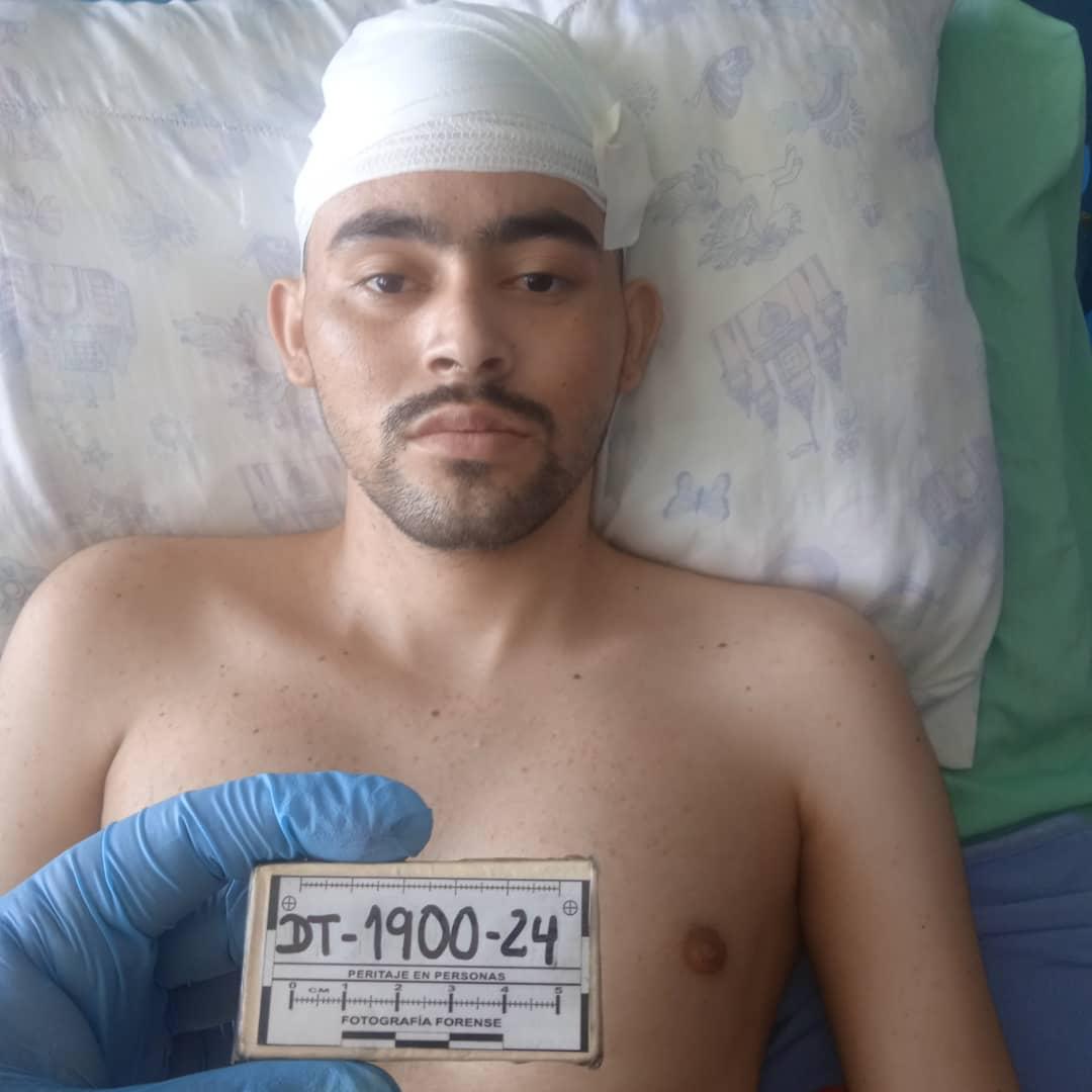 #Portuguesa | Tribunal acuerda arresto domiciliario a recluso operado por tumor cerebral en Guanare - unaventanaalalibertad.org/portuguesa-tri… 

#UVLObserva #25noviembre