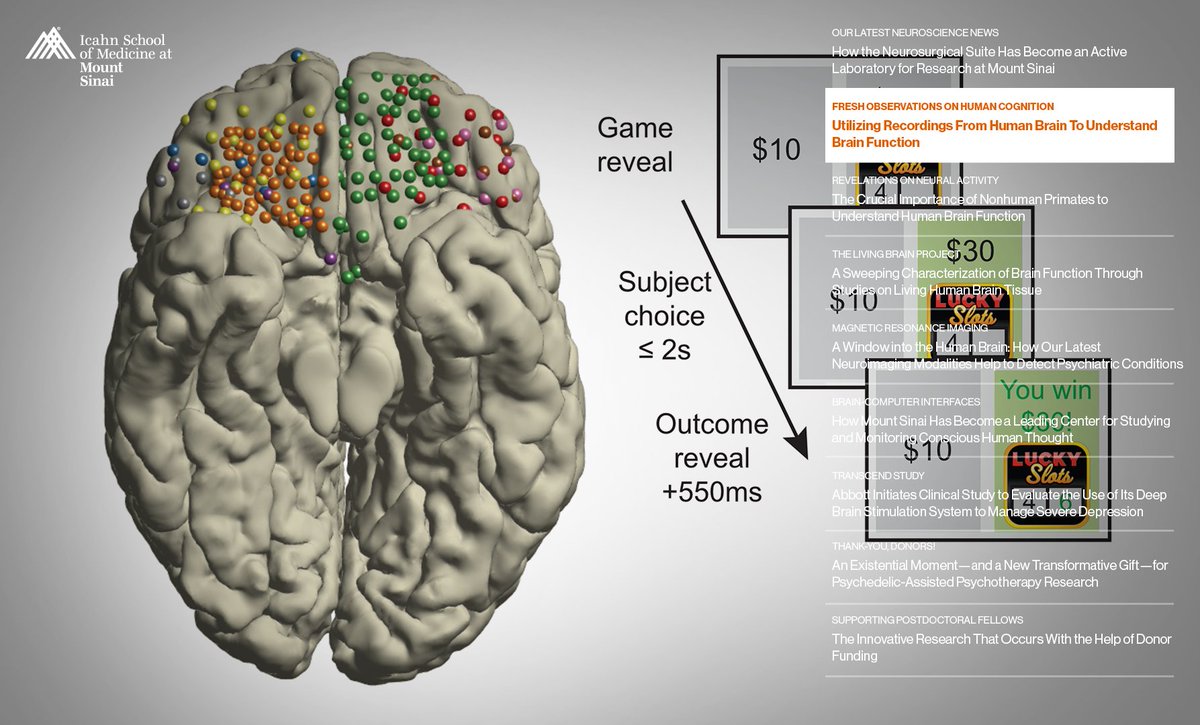 Friedman Brain Institute (@sinaibrain) on Twitter photo OUT NOW! The FALL '24 #FBINewsletter: LEARN HOW Mount Sinai neuroscientists, by leveraging clinically invasive interventions, are gaining insights into function of brain areas, brain circuits, neurotransmitters & neurons at unprecedented levels of detail👉reports.mountsinai.org/article/fbifal… OUT NOW! The FALL '24 #FBINewsletter: LEARN HOW Mount Sinai neuroscientists, by leveraging clinically invasive interventions, are gaining insights into function of brain areas, brain circuits, neurotransmitters & neurons at unprecedented levels of detail👉reports.mountsinai.org/article/fbifal…