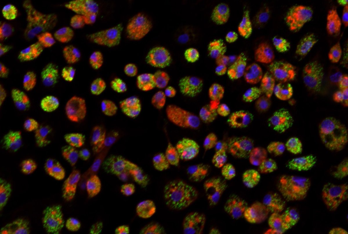 Un estudio liderado por el argentino Ariel Bazzini <a href="/BazziniLab/">BazziniLab</a> descubrió un mecanismo inesperado que usan los virus para ser exitosos y causar infección. El trabajo, que puede ayudar al diseño de nuevas vacunas,  fue portada de Molecular Systems Biology. bit.ly/3V6HWqi