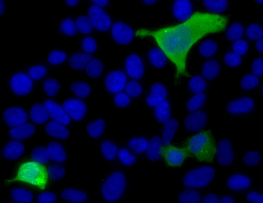 SciImmunology's tweet photo. New preclinical research suggests that GGNBP2 mediates #autoinflammation triggered by innate immune sensing of self double-stranded RNA in the absence of #ADAR1 activity. @jacki_hf
Read more in Science #Immunology: https://t.co/Cf3wSuHwyX https://t.co/NFsjK1q3Ip
