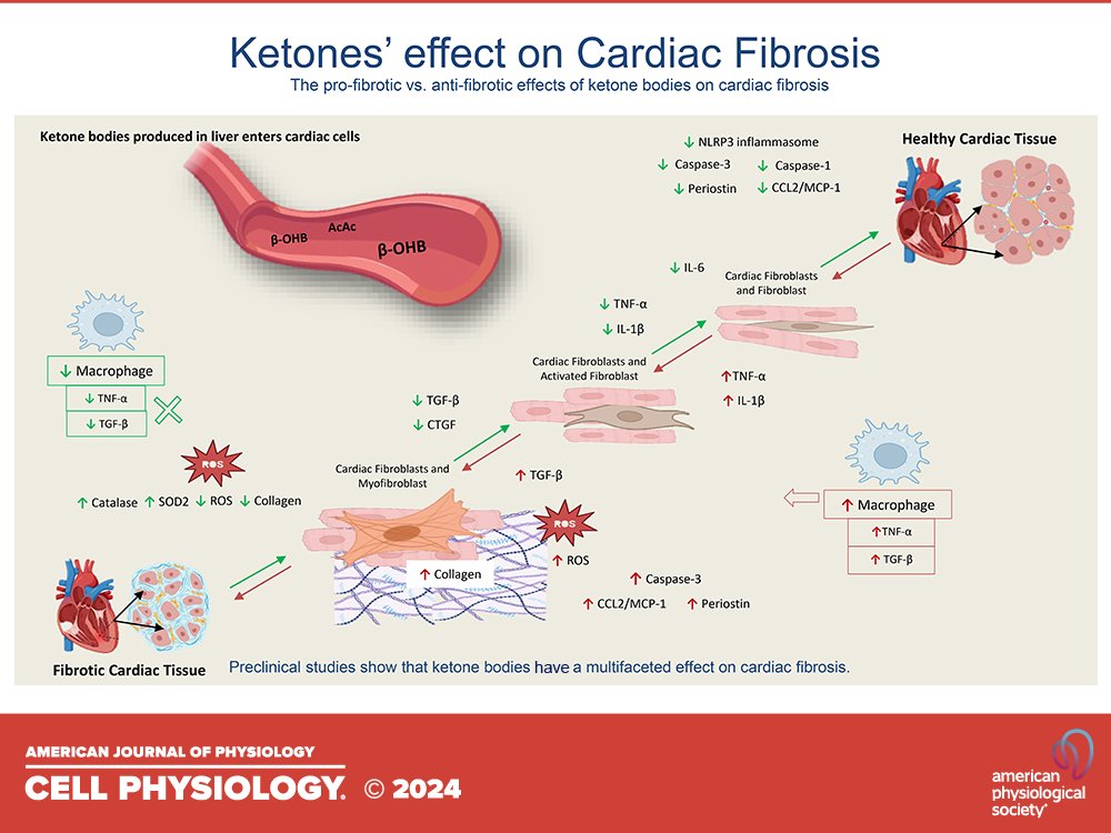 Emerging roles of ketone bodies in cardiac fibrosis

journals.physiology.org/doi/abs/10.115… <a href="/JPhysiol/">Journal of Physiology</a> <a href="/ThePhySoc/">The Physiological Society</a> <a href="/APSPhysiology/">American Physiological Society</a>