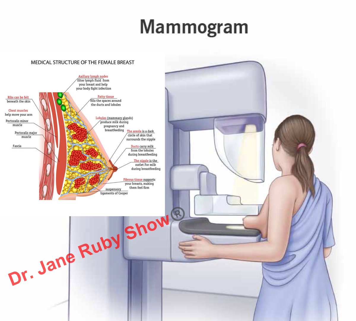 Mammograms CAUSE CANCER

Breast tissue is comprised of complex, delicate structures like ducts, mammary glands, tubules. Crushing all those structures down flat, and then radiating through condensed tissues begins the mechanical and chemical damage. 

U.S. Medical System Is A