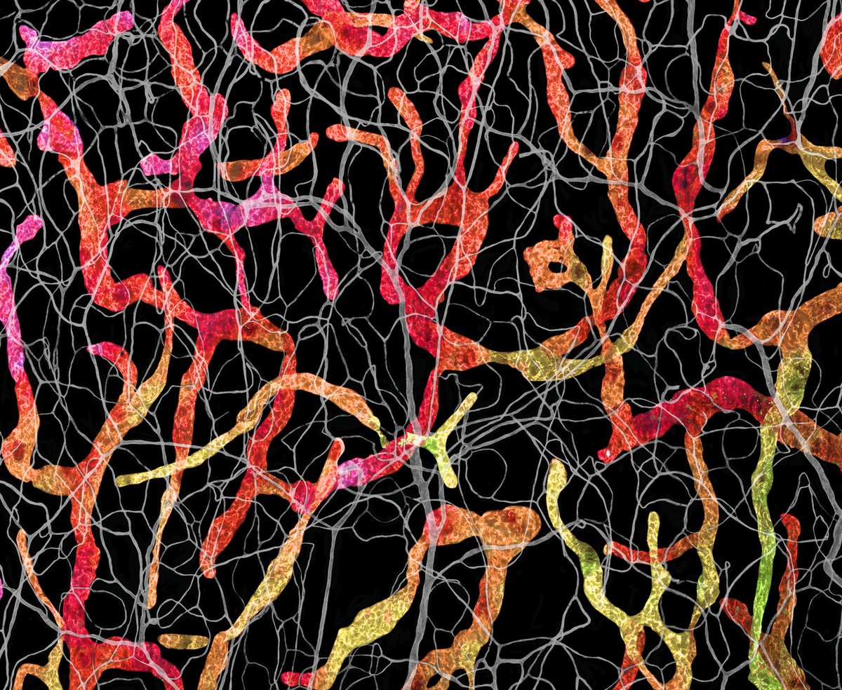 Marine Biological Laboratory (MBL) (@mblscience) on Twitter photo #MicroscopyMonday🔬| This image of blood and lymphatic vasculatures in the ear skin of an adult mouse placed 13th in the 2023 <a href="/NikonSmallWorld/">Nikon Small World</a> competition. 10x mag. Credit: Satu Paavonsalo & Dr. Sinem Karaman, University of Helsinki #MicroscopyMonday🔬| This image of blood and lymphatic vasculatures in the ear skin of an adult mouse placed 13th in the 2023 <a href="/NikonSmallWorld/">Nikon Small World</a> competition. 10x mag. Credit: Satu Paavonsalo & Dr. Sinem Karaman, University of Helsinki