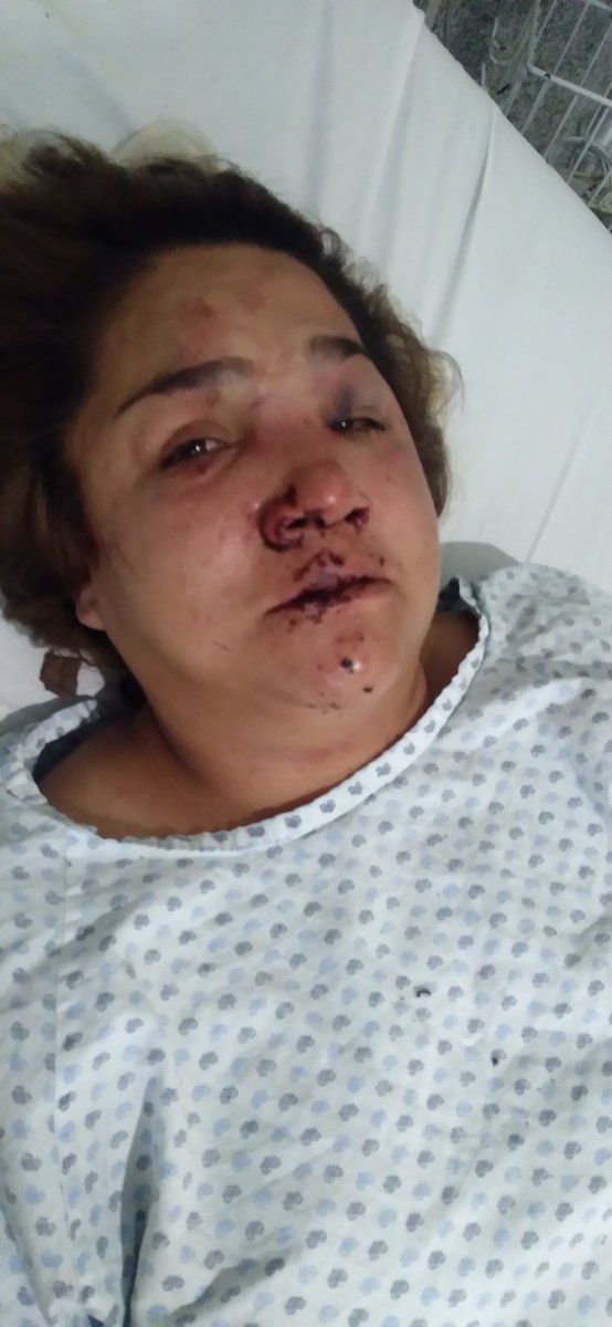 morales_2008's tweet photo. Esta ahí desde las 7am espera do no ser una carpeta más de homicidio y una madre qué deja a 2 hijas guerfanas así es como la dejo su agresor, suplicamos brinden el apoyo cuanto antes @Claudiashein @OHarfuch @GN_MEXICO_ @delfinagomeza @FiscaliaEdomex @TecamacFiscalia https://t.co/wfIivr9Aw4