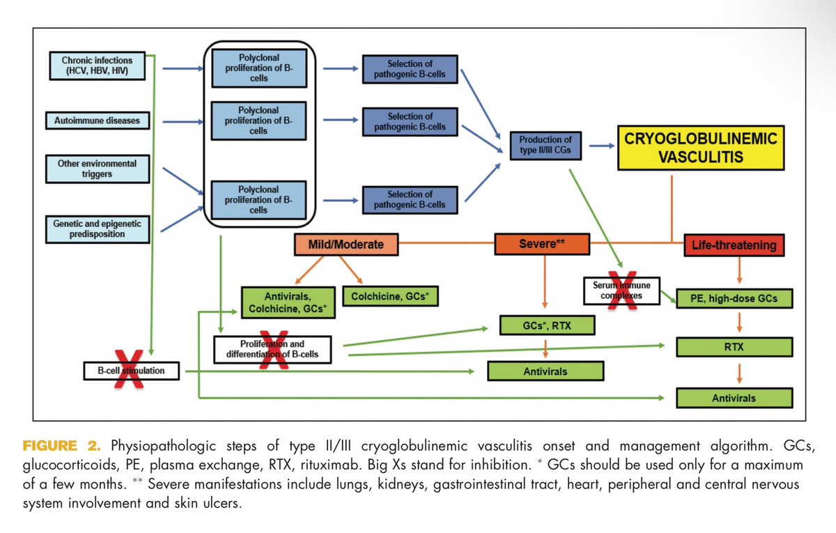 Cryoglobulinemic Vasculitis Types II/III

doi.org/10.1097/BOR.00…

#RheumTwitter #Rheumatology #MedX
<a href="/DrAkhilX/">Dr. Akhil 🇮🇳</a> <a href="/IhabFathiSulima/">Dr Ihab Suliman</a> <a href="/Janetbirdope/">Janet Pope</a>