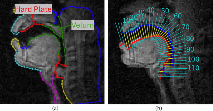Variability in speech pronunciation impacts modern automatic speech recognition performance. Researchers evaluated the performance of a self-supervised speech model in phoneme recognition using direct articulatory evidence. doi.org/10.1121/10.003…

<a href="/USC_SAIL/">SAIL</a>